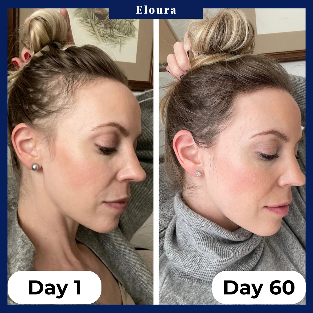 Eloura Hair Growth Serum Roll