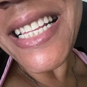 Customer smile result