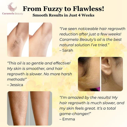 Eloura Cyperus Rotundus Oil for Natural Permanent Hair Reduction