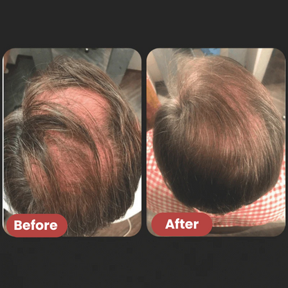 Eloura Hair Growth Serum Roll-on